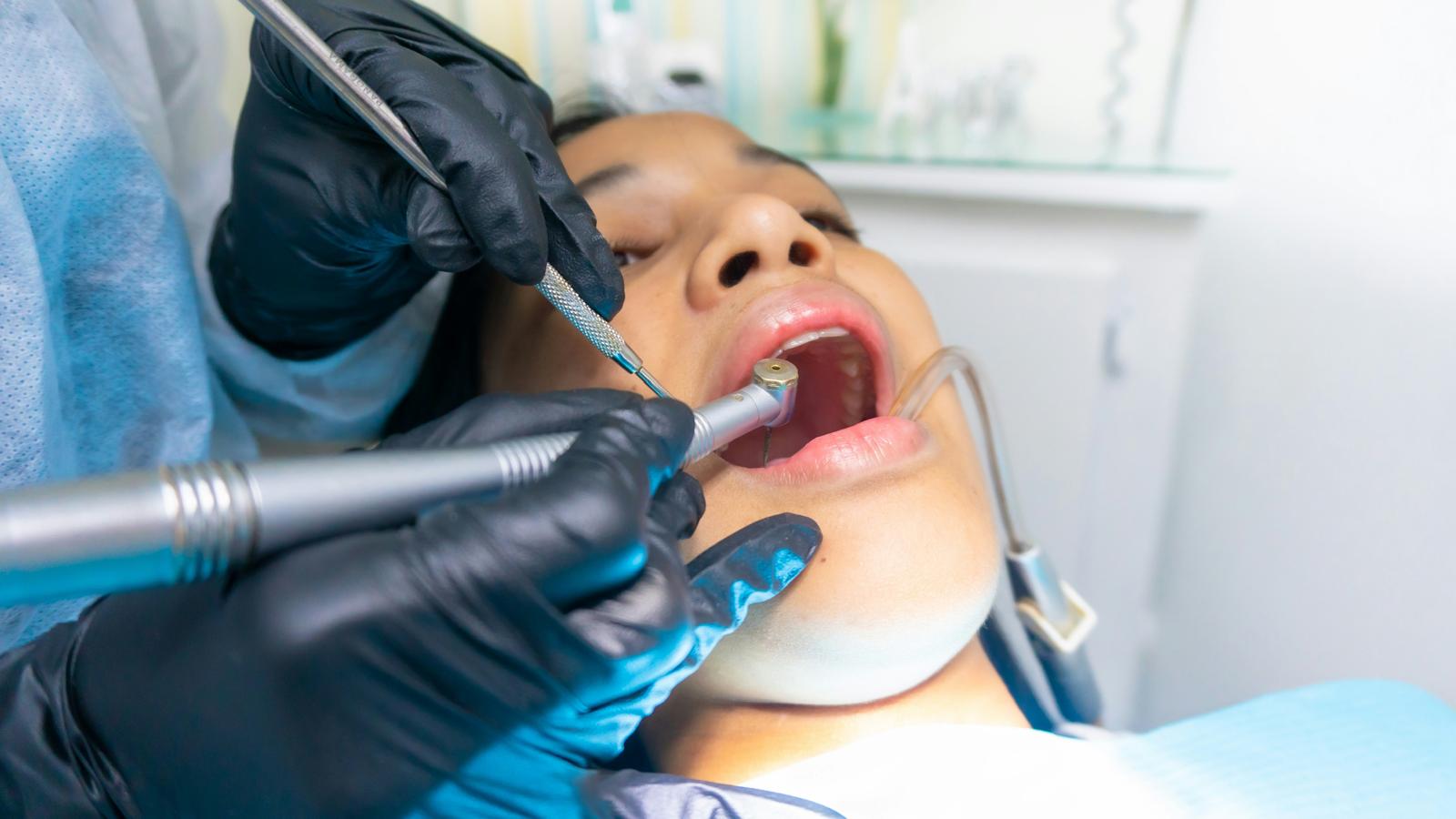 Fillings - Restorative Dentistry