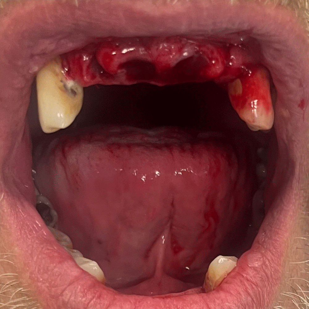Dentures in Birstall